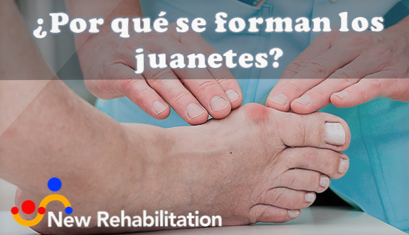 Por qué se forman los juanetes