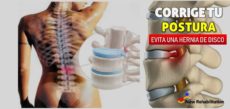 Una mala postura, ¿puede originar hernia de disco?