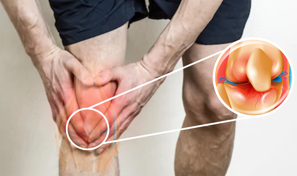 Cetosis dolor muscular mareo confusion