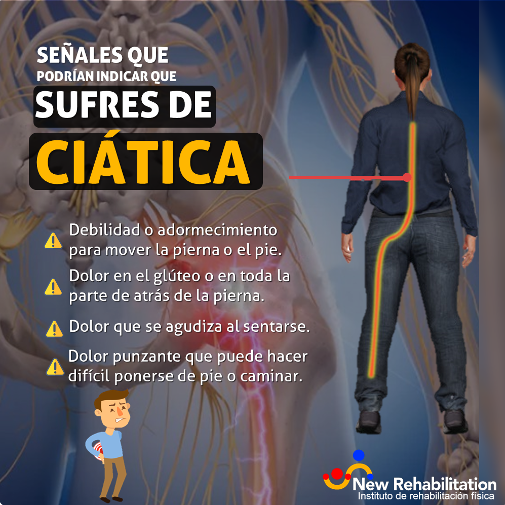 Señales que podrían indicar que sufres de ciática