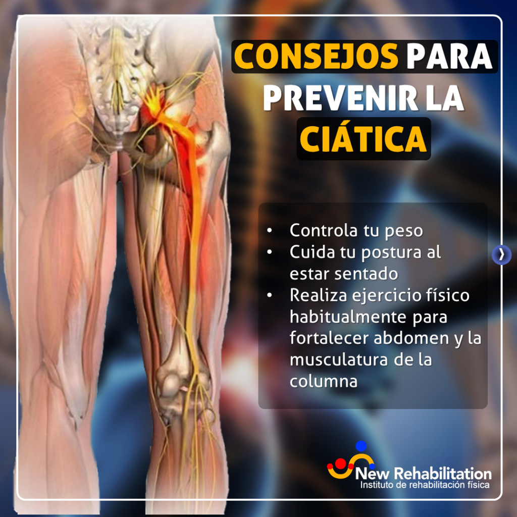 Consejos para prevenir la ciática