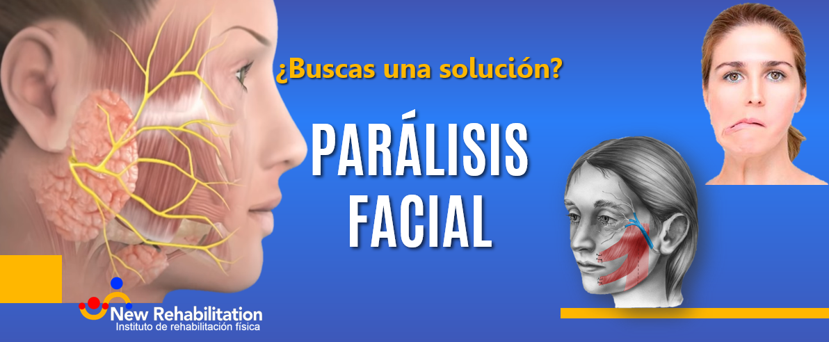 ¿Qué es una parálisis facial y cómo recuperarte?